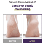 Foot Callus Remover Home Care Set - 이미지 6